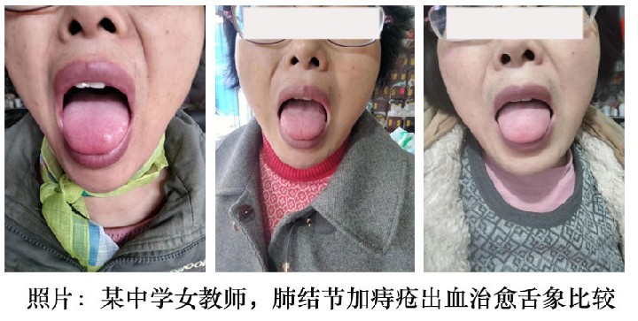 某中学女教师 1合图1jpg.jpg