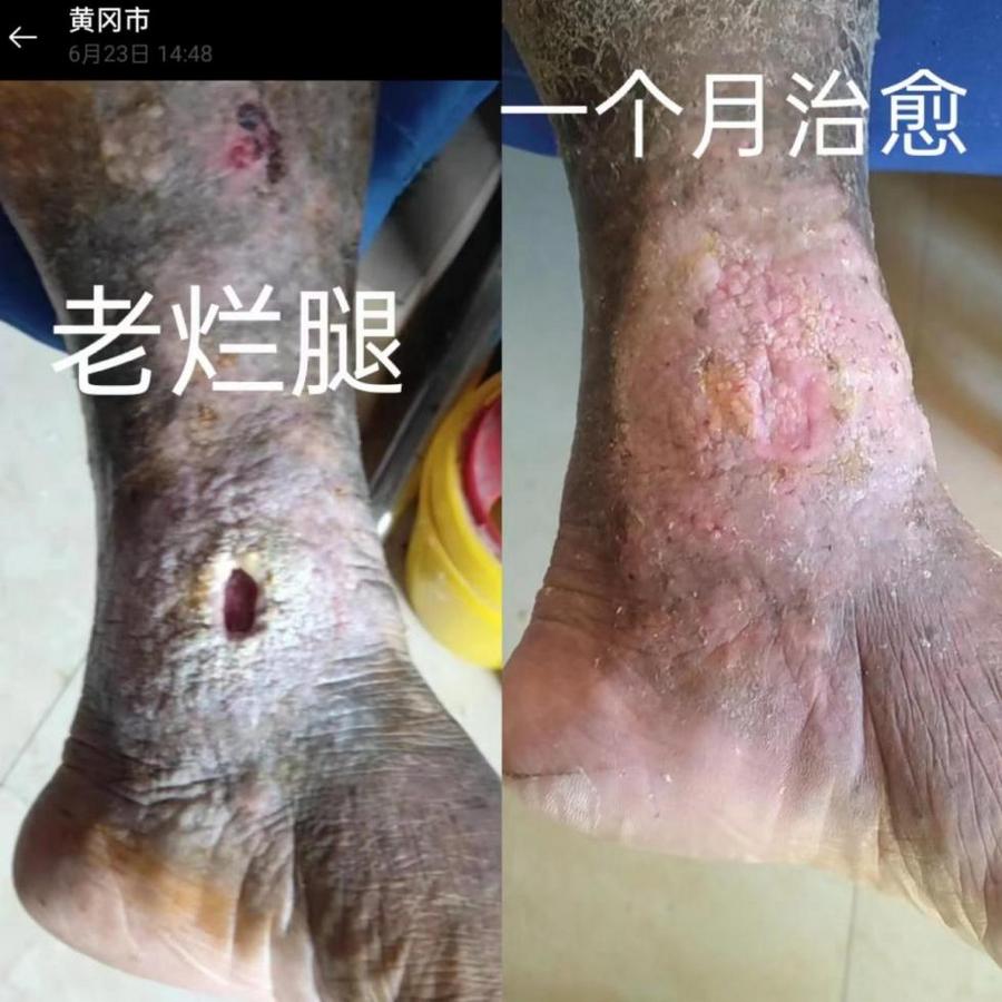 b3064f2044a09c827909fddd68225da