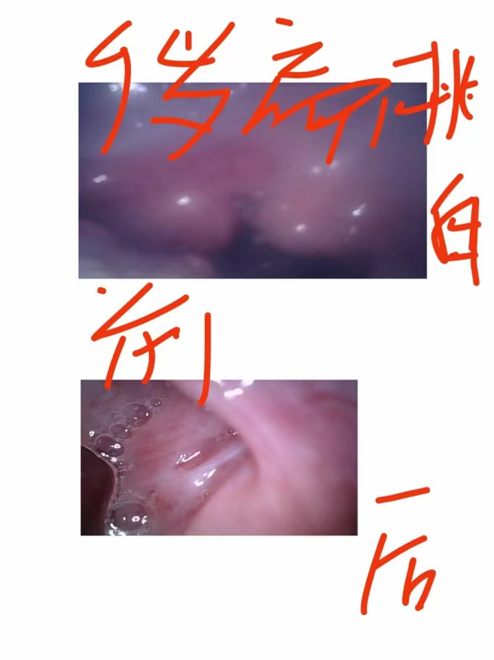 8a6b11e6e59ba68e76a8ccbcf530d87